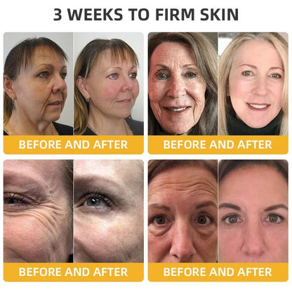 Alcuras™ BeeLift Anti-Aging Firming Cream,Address Crepe & Sagging(🔥49% Off for a Limited Time!)