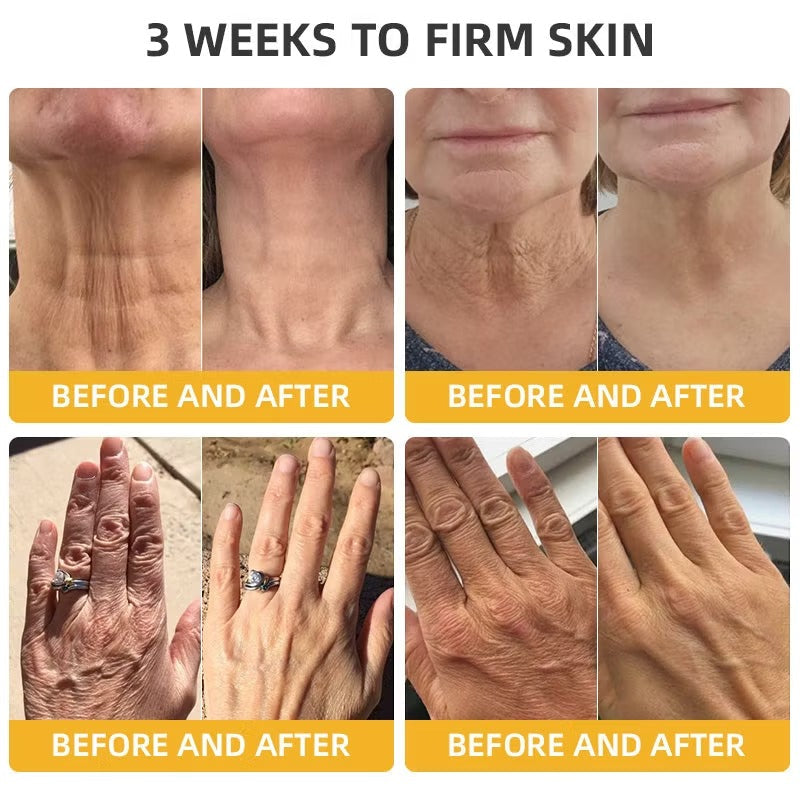 Alcuras™ BeeLift Anti-Aging Firming Cream,Address Crepe & Sagging(🔥49% Off for a Limited Time!)