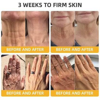 Alcuras™ BeeLift Anti-Aging Firming Cream,Address Crepe & Sagging(🔥49% Off for a Limited Time!)